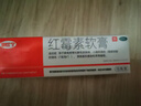 快比寧 紅霉素軟膏15g 正品消炎抗菌止癢私處祛痘痘痤瘡皮膚瘙癢燒燙擦傷外用藥唇炎嬰兒童非羅紅梅素藥乳膏 曬單實(shí)拍圖