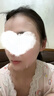 Newliann醫用械字號面膜冷敷貼醫美術(shù)后修復保濕補水激光修護祛痘痤瘡皮炎 曬單實(shí)拍圖