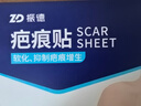 振德醫用硅酮疤痕貼祛疤去疤痕貼美皮美膚護理剖腹產(chǎn)甲狀腺 6*12cm1片 曬單實(shí)拍圖