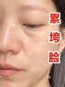 修正美白祛斑面霜去雀斑老年斑淡化黑色素黃褐斑曬斑女男士官方正品 1瓶【官方正品】祛斑去黑美白色素 曬單實(shí)拍圖