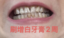 高露潔（Colgate）速感白美白牙膏去煙漬去黃去口臭亮白男士女士進(jìn)口85g*2 包裝隨機 曬單實(shí)拍圖