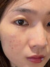 BEAUTY NOTES壬二酸凝膠20%祛痘藥膏淡化痘印痘坑修復男士水楊酸消炎痤瘡專(zhuān)用 曬單實(shí)拍圖