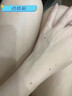 MEROYDOCTOR去痣點(diǎn)痣膏正品點(diǎn)痣無(wú)痛無(wú)痕祛痣黑痣臉部去痣祛斑專(zhuān)用不留疤痕 曬單實(shí)拍圖