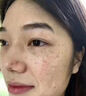 YYTISS377美白祛斑霜官方正品煙酰胺祛斑美白淡化黑色素去黃褐雀斑曬斑 曬單實(shí)拍圖