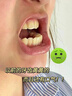 韓方五谷酵素牙膏美牙亮白口臭清新口氣牙結石垢去牙漬黃十大知名品牌320g 曬單實(shí)拍圖