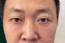 國醫制藥眼袋霜去眼袋消除重度眼袋貼專(zhuān)用嚴重中老年男士女士眼袋去除神器 一盒裝【輕度眼袋適用】 曬單實(shí)拍圖