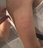 幻靈丁潔幻靈膏蕁I麻I疹膏丘I疹型急慢性蕁I麻I疹康藝邦寧 1盒【體驗(yàn)裝】 曬單實(shí)拍圖