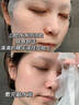 透真b5修復面膜 積雪草補水保濕 修護換季屏障敏感泛紅急救膠原蛋白女 曬單實(shí)拍圖