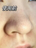 茗希芝（MINSHZEE）去黑頭清理神器深層清潔撕拉吸鼻貼面膜泥祛痘毛孔粉刺男女士收縮 2套【到手40條+2瓶導出液】 曬單實(shí)拍圖