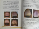【官方正版】現貨速發(fā) 臨床實(shí)用舌象圖譜 王彥暉 舌診辯證圖譜圖解 舌診書(shū)中醫舌診 手診面診舌診書(shū) 中醫舌診臨床圖解看舌苔書(shū) 曬單實(shí)拍圖