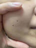 香港大藥房去痣點(diǎn)痣膏無(wú)痕點(diǎn)疣藥水黑痣痦子臉部不留疤100%特效修復不留坑 點(diǎn)痣套裝1盒裝【無(wú)痛脫落】 曬單實(shí)拍圖