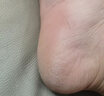 BIPI德國馬油防裂膏手足裂干裂腳后跟開(kāi)裂愈合皮膚干燥皸裂護手霜冬季 曬單實(shí)拍圖