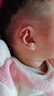 新生兒耳廓矯正器嬰兒耳朵矯正醫院同款耳畸形矯形器寶寶耳朵定型 右耳全套（定制方案） 透明 曬單實(shí)拍圖