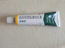 【原研好藥】派瑞松 曲安奈德益康唑乳膏軟膏15g正品皮炎濕疹過(guò)敏止癢水泡腳氣 手足癬體癬股癬花斑癬 甲溝炎 曬單實(shí)拍圖
