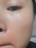 汗管瘤眼部去除油脂粒祛眼部周?chē)玖?zhuān)用眼霜眼油脂粒涂抹藥膏 單盒裝 曬單實(shí)拍圖