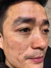 泊泉雅老年斑專(zhuān)用的藥膏一夜消強力去除老人斑臉部黑色素手背專(zhuān)用祛斑霜 特效【1盒裝】快速祛斑 曬單實(shí)拍圖