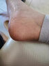 腳裂膏腳后跟干裂開(kāi)裂真菌感染手足干裂脫皮膏龜裂腳裂口干燥正品 100g 1瓶 【手腳干裂專(zhuān)用】 曬單實(shí)拍圖