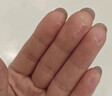 手部角化型濕疹可搭藥膏手足癬真菌感染手指手掌皮膚瘙癢干燥粗糙硬塊皸裂角化皸裂性濕疹抑菌止癢膏 單盒裝 曬單實(shí)拍圖