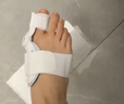 冠愛(ài)（GUANAI）醫用腳趾矯正器大拇指外翻矯正器成人大腳趾頭腳骨分趾器可穿鞋 曬單實(shí)拍圖