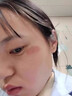 去疤痕修復(fù)凝膠醫(yī)院專用祛疤膏手術(shù)縫針增生凸起除疙瘩淡化黑色素 1盒【祛疤痕專用修復(fù)】多買多送部分地區(qū)次日達(dá) 芭痕克星醫(yī)用硅酮去除巴痕修復(fù)凝膠愈合傷口 曬單實(shí)拍圖