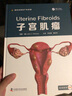 子宮肌瘤 曬單實(shí)拍圖