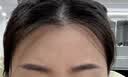 絲幕川字紋去除神器男女士填充去皺紋法令紋抬頭紋眉間隱形貼修復(fù)凝膠 【拍3發(fā)5】12貼/盒 中度癥狀 曬單實(shí)拍圖