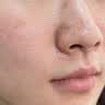 BEAUTY NOTES多肽寡肽凍干粉精華液痘淡化痘印痘坑毛孔收縮次拋男女士修護粉刺 曬單實拍圖