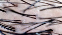 澳宝康（AOBAOKANG） 无线毛囊毛发头皮检测仪高清检查仪器连接手机头发皮肤水分测试仪脸部 四光谱双探头检测【测头皮和皮肤】【会员建档对比】 实拍图