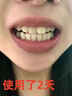 齒貝白牙斑凈洗牙去黑煙漬去黃牙結石牙斑菌牙垢去除神器美白清新口氣 1盒【日本進口】 曬單實拍圖