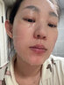 維特絲面膜美白淡斑補水保濕男女士熬夜舒緩抗皺緊致去黃氣暗沉提亮膚色 曬單實拍圖