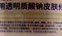 沃朗森醫(yī)用面膜械字號冷敷貼醫(yī)美術(shù)后補水修復(fù)祛痘印消炎透明質(zhì)酸鈉5盒 曬單實拍圖