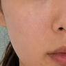 醫(yī)續(xù)美收縮毛孔粗大修復(fù)細(xì)致醫(yī)用毛孔臉部鼻子粗糙精華液蜂窩臉凝膠TU 兩盒 75 折【膠原填充毛孔細(xì)膩】 曬單實(shí)拍圖