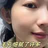 DR.NEUER毛孔收縮精華液去黑頭修復毛孔粗大閉口痘印控油補水男女士120ml 曬單實拍圖
