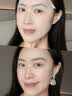 Treesymbol進(jìn)口B5修復(fù)爽膚水補(bǔ)水保濕舒緩敏感肌修護(hù)皮膚屏障保濕水120ml 曬單實(shí)拍圖