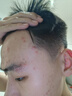 溪木源愈創木抗痘水乳套裝舒緩油痘敏感肌凈膚平衡油脂 【七夕禮盒裝】水150ml+乳75ml+精華 曬單實拍圖