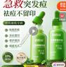 白云山積雪草祛痘精華液去痘痘和痘印痘坑收縮毛孔粗大修護細致舒緩提亮 曬單實拍圖