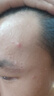 溪木源愈創木抗痘水乳套裝舒緩油痘敏感肌凈膚平衡油脂 【七夕禮盒裝】水150ml+乳75ml+精華 曬單實拍圖