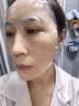 WIS玻尿酸面膜20片抗皺緊致補(bǔ)水保濕修護(hù)舒緩維穩(wěn)控油七夕禮物送女友 曬單實拍圖