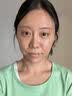 OHBT膠原蛋白面膜抗皺緊致抗衰老補水美淡白斑去黃氣暗沉提亮膚色男女 曬單實拍圖