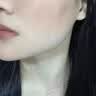 玫黛琳曬傷修復面膜紫外線白美兒童6-12歲小男女童補水防曬黑后急救面膜 紫外線曬傷修復面膜曬黑急救專用 日光性皮過敏炎專用（一盒/5片） 曬單實拍圖