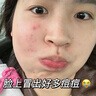 儒意積雪草泡泡面膜清潔黑頭水楊酸去粉刺閉口毛孔深層清潔泥膜官方 2盒 【輕度清潔】 96g 曬單實(shí)拍圖