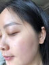 卓姿泉杏仁酸水楊酸精華液乳糖酸原液果酸黑頭閉口粉刺痘痘毛孔粗大可用 1瓶/30ml 曬單實(shí)拍圖