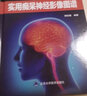 實(shí)用癡呆神經(jīng)影像圖譜 鄭東明編著 癡呆相關(guān)疾病神經(jīng)影像特點(diǎn)閱片思路注意事項(xiàng) 北京大學(xué)醫(yī)學(xué)出版社9787565926143 曬單實(shí)拍圖