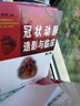 【正版現貨】冠狀動(dòng)脈造影與臨床 第3版 第三版 冠脈造影 介入心臟病學(xué) 心血管內科外科醫師冠狀動(dòng)脈造影參考書(shū)籍 遼寧科學(xué)技術(shù)出版社 曬單實(shí)拍圖
