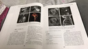乳腺影像診斷學(xué) 第二2版（翻譯版）新版 彭衛軍 顧雅佳主譯精裝彩色圖解影像醫學(xué)診斷學(xué) 曬單實(shí)拍圖