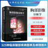 腦部影像診斷學(xué) 第3版 王任直 田蕊 主譯 腦部畸形 中毒代謝性疾病 創(chuàng  )傷感染診斷 影像醫學(xué)書(shū)籍 人民衛生出版社9787117297295 曬單實(shí)拍圖