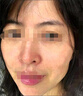 卡倫亞女痘痘修復(fù)面膜人源化膠原蛋白貼修護痘印5片敏感肌美容激光修復(fù) 10盒 曬單實拍圖