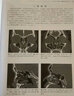 鼻內鏡外科學（第2版） 曬單實拍圖