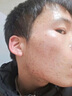 百幽草南京同仁堂 水楊酸祛痘膏痘痘印痘坑呵護痘肌亮膚青春痘男女通用 【一支裝】 30g 曬單實(shí)拍圖
