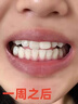 齒貝白牙斑凈洗牙去黑煙漬去黃牙結石牙斑菌牙垢去除神器美白清新口氣 1盒【日本進口】 曬單實拍圖